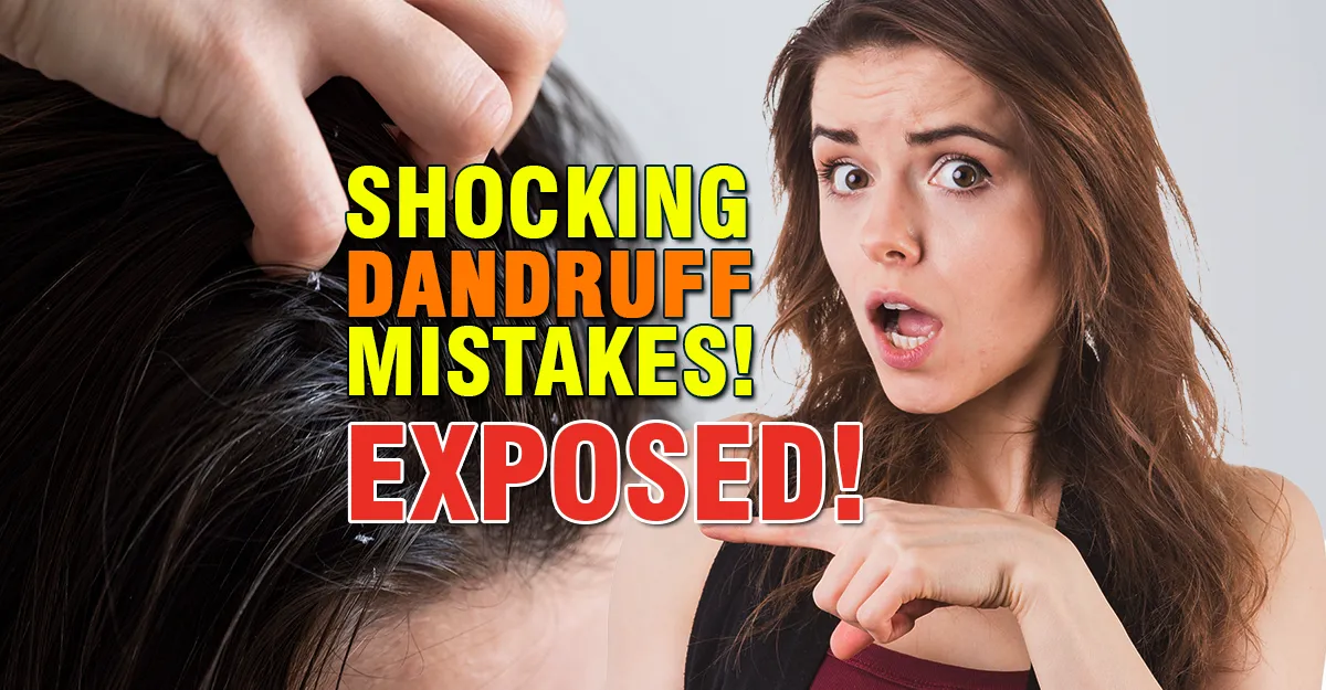 Shocking Dandruff Mistakes Exposed!