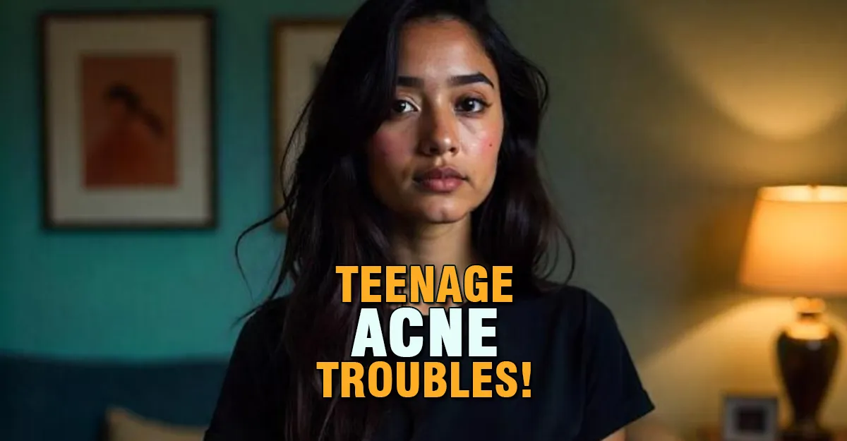 Teenage Acne: Concerns & 5 Amazing Remedies