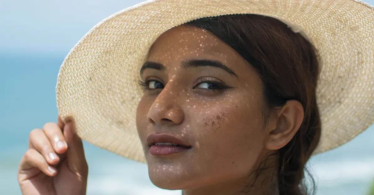 Woman in a hat with melasma