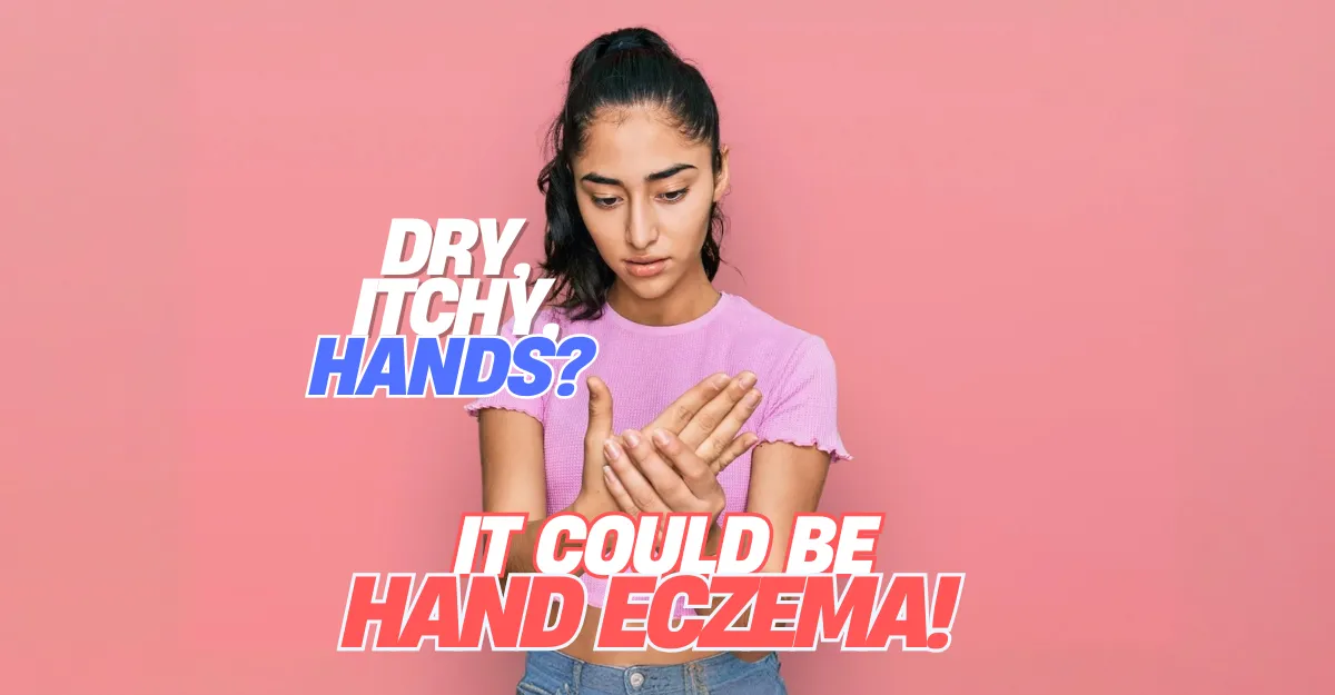 Itchy, Dry, Cracked Hands Could Be Hand Eczema