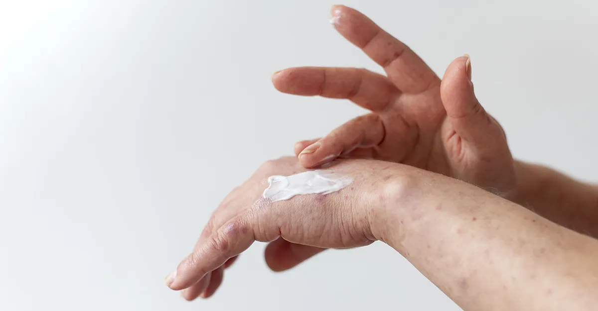 Applying ointment to hand